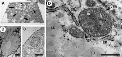 Ultrastructural analysis of prostate cancer tissue provides insights into androgen-dependent adaptations to membrane contact site establishment